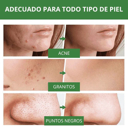 Green Mask Mascarilla de Limpieza Profunda de té Verde - [PROMOCIÓN DISPONIBLE SOLO HOY]